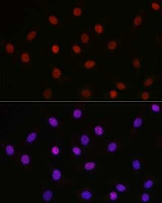 Immunocytochemistry/Immunofluorescence: HMGB1/HMG-1 [ac Lys29] Antibody [NBP3-15486] - Immunofluorescence analysis of NIH-3T3 cells using [KO Validated] HMGB1/HMG-1 Rabbit pAb (NBP3-15486) at dilution of 1:100 (40x lens). Blue: DAPI for nuclear staining.